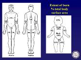 Burns Initial Evaluation and Management
