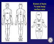 Burns Initial Evaluation and Management PowerPoint Presentation