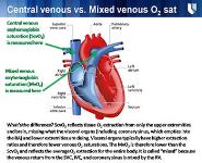 Management of Sepsis PowerPoint Presentation