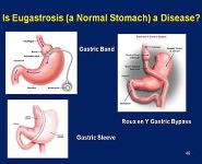 Obesity Dyslipidemia And The Metabolic Syndrome PowerPoint Presentation Notes