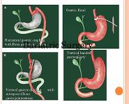 Pediatric Obesity And The Metabolic Syndrome PowerPoint Presentation