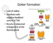 Thyroid Gland Disorders PowerPoint Presentation Notes