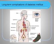 Long-Term Complications of Diabetes Mellitus PowerPoint Presentation
