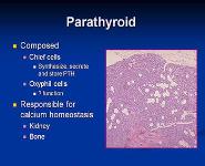 Hypercalcemia PowerPoint Presentation Notes