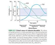 Hyperthyroidism PowerPoint Presentation