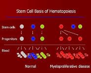 Thrombocytosis Essential and Reactive PowerPoint Presentation