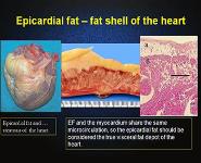 Atherosclerosis Is The Liver Disease PowerPoint Presentation