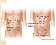 Approach to Abdominal Pain PowerPoint Presentation
