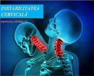 Instabilitate Cervicala PowerPoint Presentation Notes