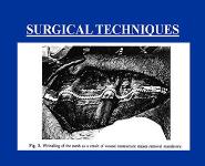 Antibioprophylaxis PowerPoint Presentation Notes