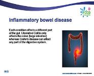 Inflammatory Bowel Disease PowerPoint Presentation Notes