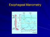 About Esophageal Motility Disorders