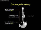 Esophageal Motility Disorders