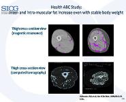 Geriatric Syndromes PowerPoint Presentation Notes