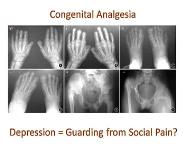 Pain and Depression in Older Adults PowerPoint Presentation