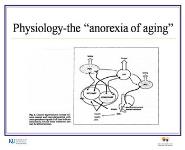 Malnutrition and the older patient PowerPoint Presentation Notes