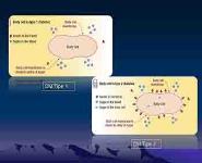 Diabetes Melitus Type 1 PowerPoint Presentation