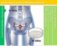 Introduction to IVF PowerPoint Presentation