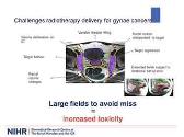Radiotherapy Research in Gynaecological Cancers