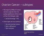 Ovarian Cancer 101 PowerPoint Presentation Notes