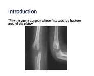 Elbow Injuries PowerPoint Presentation