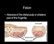 Hand Infections PowerPoint Presentation Notes