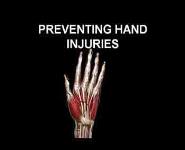 Preventing Hand Injuries PowerPoint Presentation