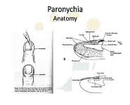 Hand Infections PowerPoint Presentation