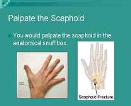 Wrist and Hand PowerPoint Presentation