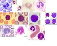 RBC and Bleeding Disorders PowerPoint Presentation