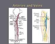 Deep Vein Thrombosis PowerPoint Presentation Notes