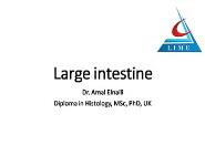 inflammatory bowel disease PowerPoint Presentation