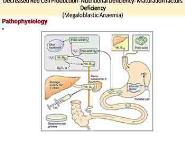 Anemia PowerPoint Presentation