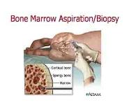 Lymphoma PowerPoint Presentation