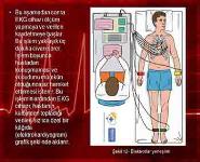 EKG PowerPoint Presentation