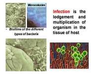 Infection and Infectious Process PowerPoint Presentation