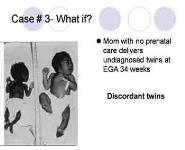 Intrauterine Growth Restriction IUGR PowerPoint Presentation