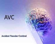 Accident Vascular Cerebral PowerPoint Presentation