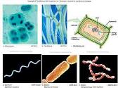 Infectious Diseases