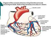 Myocardial Infarction