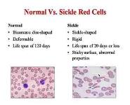Sickle Cell Disease-Epidemiology Genetics Pathophysiology PowerPoint Presentation Notes