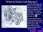 What Is Sickle Cell Disease