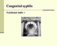 Prenatal Infections PowerPoint Presentation