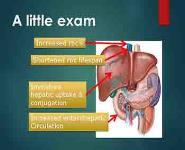 Neonatal Jaundice PowerPoint Presentation Notes