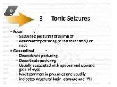 Neonatal Seizures