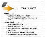 Neonatal Seizures PowerPoint Presentation