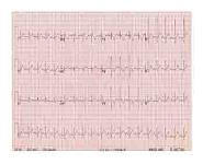 Paediatric Cardiology PowerPoint Presentation