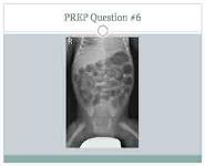 Primary Care of The Preterm Infant PowerPoint Presentation Notes