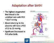 Pulmonary Complications of Congenital Heart Disease PowerPoint Presentation