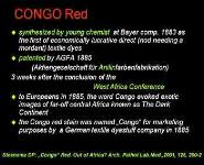 Amyloidosis Fibrinoid and Hyalin PowerPoint Presentation